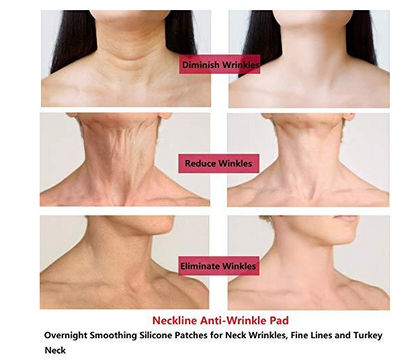 Silicone Neck Patch for Wrinkle Prevention