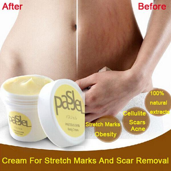 Stretch Mark Repair Cream for Reducing Scars