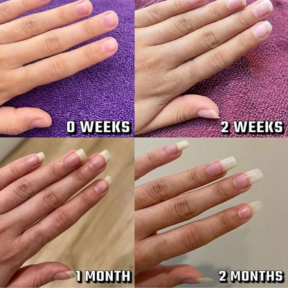 Vitality Nail Growth Oil
